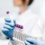 Flow cytometry analysis microbiology